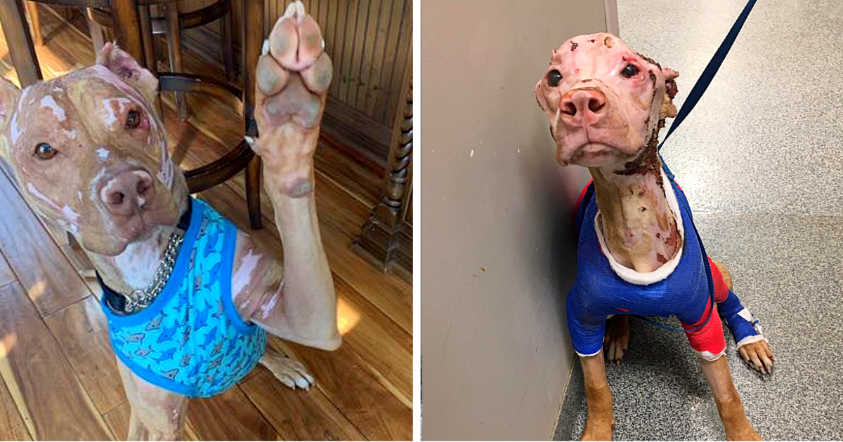 Severely Burned Pitbull Defied The Odds And Now He Loves Life